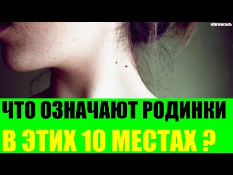 Что означают родинки в этих 10 местах?