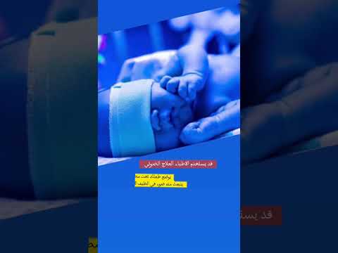 سبب ابو صفار اليرقان
