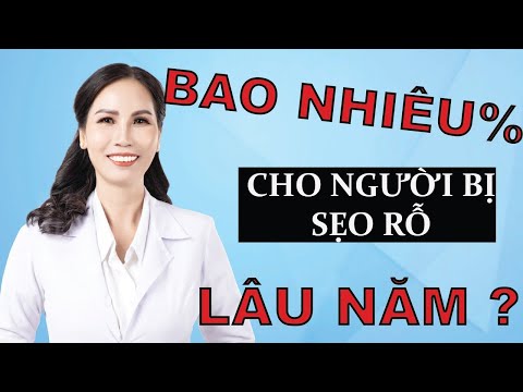 BAO NHIÊU PHẦN TRĂM CHO NGƯỜI BỊ SẸO RỖ LÂU NĂM ? | ĐIỀU TRỊ SẸO RỖ LÂU NĂM CÙNG DS.DUNG |