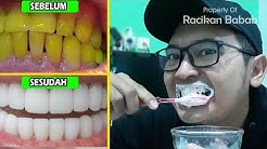 HANYA DALAM 3 MENIT GIGI KUNING JADI PUTIH BERSIH - Durasi: 4.32. 