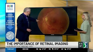 Famous Retinal imaging and why it's important Net Worth