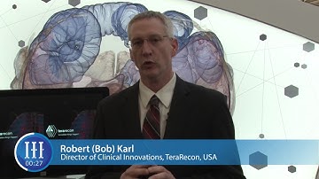 What has TeraRecon been doing in automation? Robert Karl, TeraRecon