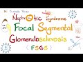 Focal Segmental Glomerulosclerosis (FSGS) | Nephrotic Syndrome | 5-Minute-Review