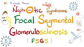 Focal Segmental Glomerulosclerosis (FSGS) | Nephrotic Syndrome | 5-Minute-Review