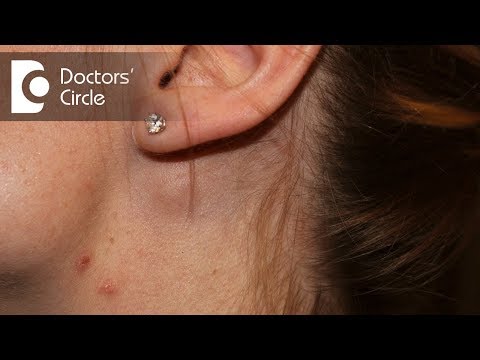 What causes swelling of lymph node near the ear in a young female? - Dr. Satish Babu K