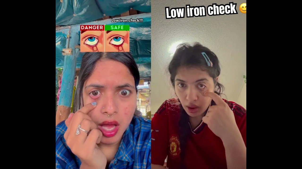 Low iron checek #its low iron what about you guys-#fyp#go viral