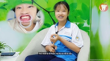 [Review tháo niềng răng] - Kết quả niềng răng hô của bé Phúc An - 16 tuổi