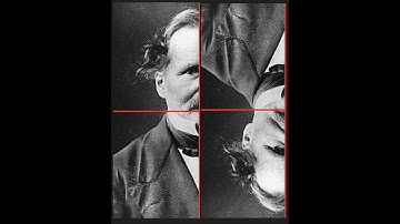 Kummer Log Gamma Expansion Odd Part