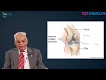 Osteoarthritis Hindi | IOACON 2017