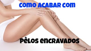 Encravados de se como coxa pêlos livrar na