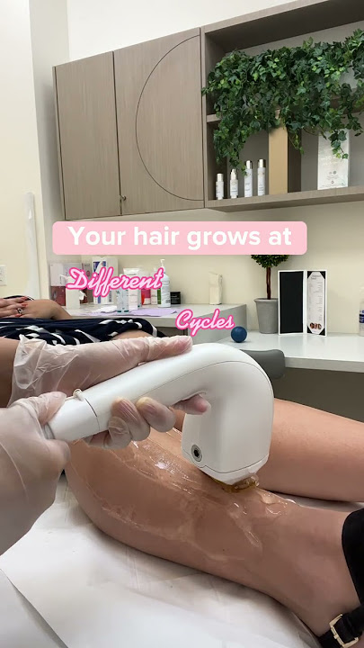 Why you need multiple sessions to see permanent laser hair removal results