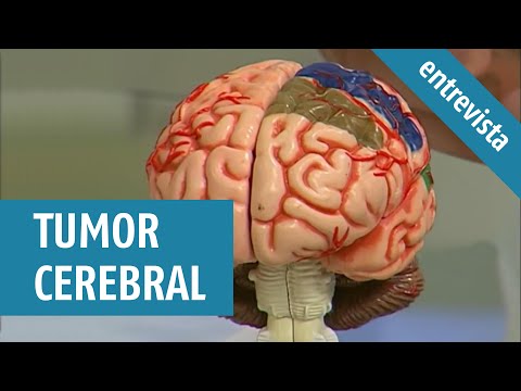 Tumor Cerebral | Causas, sintomas e tratamentos (Entrevista TV Aparecida)
