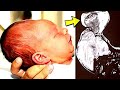 Doctors Discover Unusual Growth on Baby’s Head, Their Astonishing Findings Leave Them Speechless