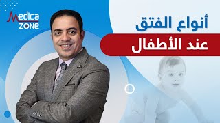 ما هي انواع الفتق عند الاطفال؟ واسبابه وعلاجه | دكتور محمد فتحي| Medicazone