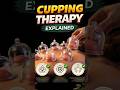 Why People Try Cupping (Hijama) | Benefits & Science Explained #hijama #cuppingtherapy #detoxSimple