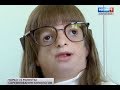Оля Каплина, 8 лет, синдром Тричера Коллинза, требуется ортодонтическое лечение