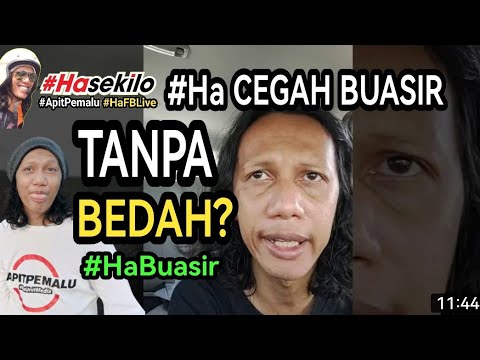 Video: Buasir 3 Darjah: Rawatan Tanpa Pembedahan Di Rumah, Kaedah