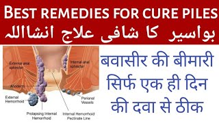 बवासीर हमेशा के लिये ख़त्म करने का अचूक घरेलू नुस्खा Piles Treatment in Hindi | Health Tips