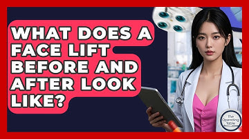 What Does A Face Lift Before And After Look Like? - The Operating Table