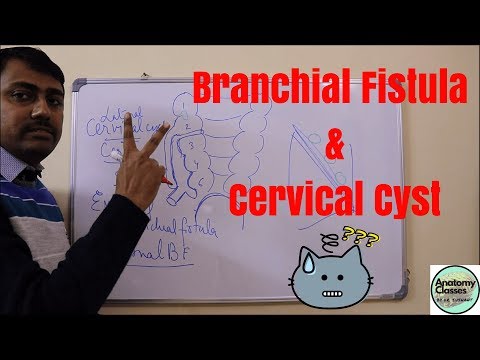 Video: Cervikal Cyste