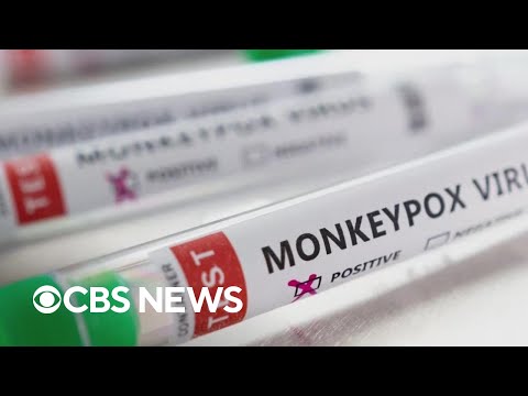 Public health expert on growing concerns about monkeypox outbreak