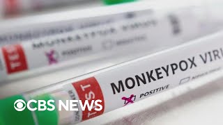 Public health expert on growing concerns about monkeypox outbreak