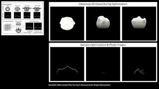 UltraDiff: Differentiable Ray Tracing in Ultrasound for Shape Optimization