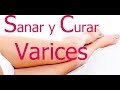 Sanar y Reparar Varices de Piernas y Cuerpo (Facíl y Sencillo)