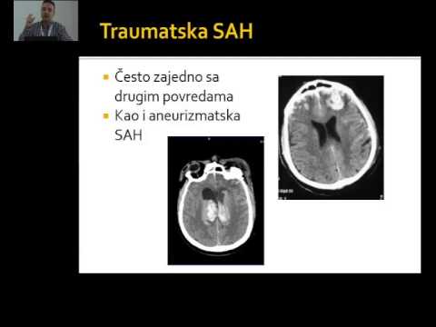 Trauma glave, Kosta Petrovic 1_05