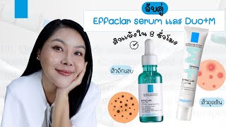 (กูรูเช็ค) รีวิวหลังใช้เซ็ต EFFACLAR SERUM และ DUO+M ลดสิวอุดตัน รอยสิว สิวแห้งทันใจใน 8 ชั่วโมง!!