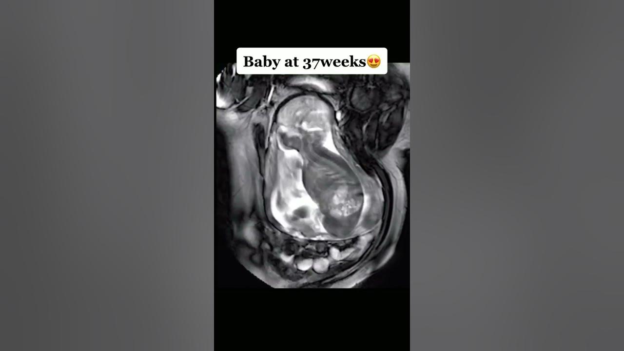 baby-at-37-weeks-moving-in-womb-youtube