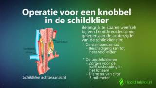 Knobbel in de schildklier