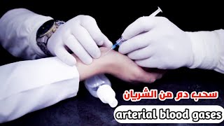 طريقه سحب دم من الشريان ABG لطلاب طب وتمريض_How to taking arterial blood gases