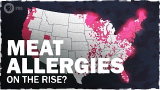Allergic to MEAT?! It's Happening Thanks to Climate Change | Hot Mess 🌎