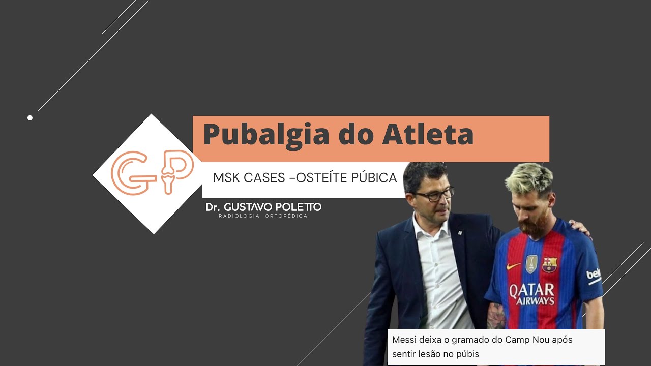 Osteíte Púbica - Pubalgia do Atleta - YouTube