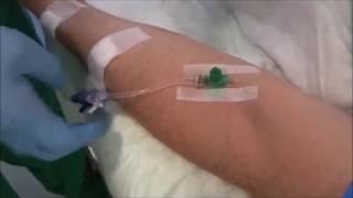 iv Access Guideline, Standard for Peripheral IV-Line (PIV)