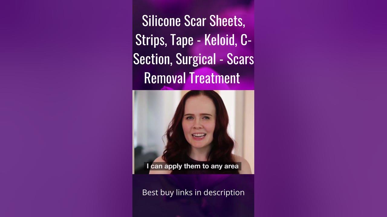 Silicone Scar Sheets, Strips, Tape - Keloid, C-Section, Surgical - Scars  Removal