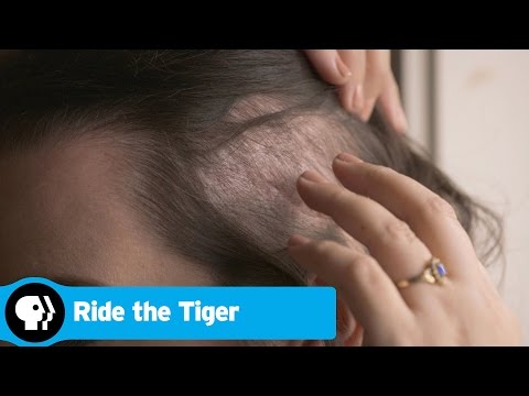 RIDE THE TIGER | Deep Brain Stimulation (DBS) | PBS