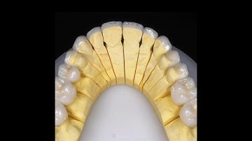 Labo Cát Tường - Nơi cung cấp sản phẩm răng sứ đến các phòng khám nha khoa trong và ngoài nước