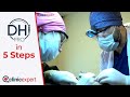 Dhi pro hair transplant  the clinicexpert exclusive hair transplant technique explained in 5 steps