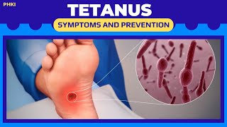 TETANUS  causes, symptoms and prevention