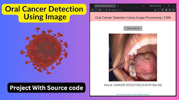 Oral Cancer Detection Using Image Processing | Deep Learning | CNN | Machine Learing | Source Code