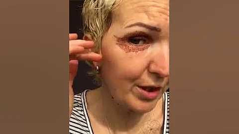 Day 2 of Vicki's post treatment vlog
