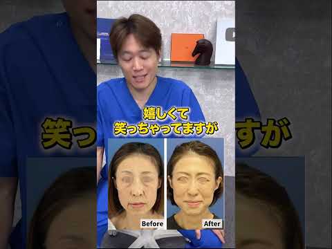 1+1を10にするアンチエイジング#shorts