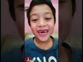 Aisy Naufal Cabut Gigi Sendiri