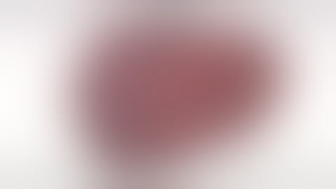 Standard right hepatectomy with PVE (Trailer) - TVASurg.ca