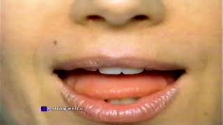 2003 Alavert Allergy Commercial