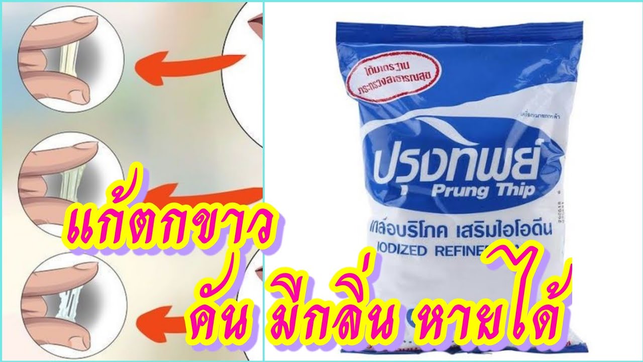 ช่องคลอดมีกลิ่น กินยาอะไรดี