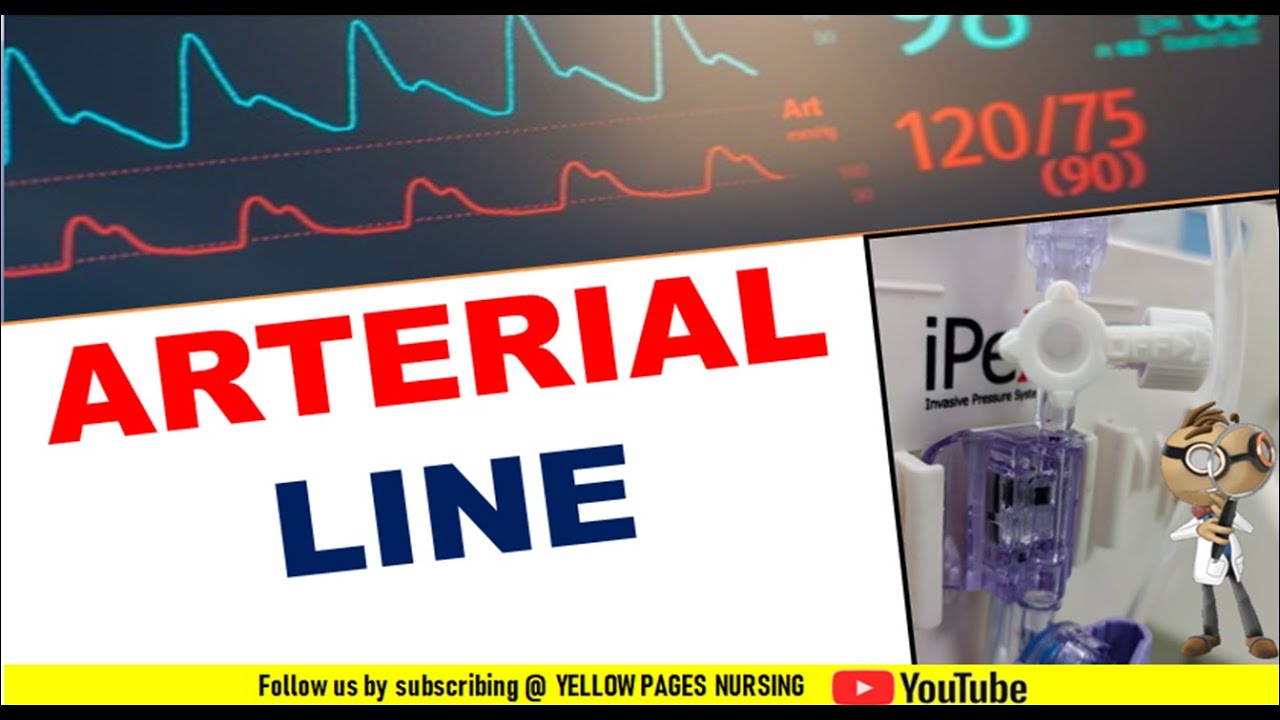 Arterial line | Transducer set-up | Arterial line-Zeroing | Square wave test | Nursing Alerts