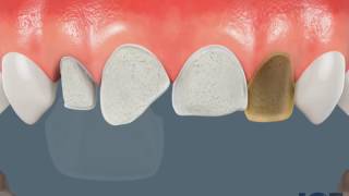 Di̇ş Heki̇mi̇ Namik Kemal Aydin Porselen Lami̇na